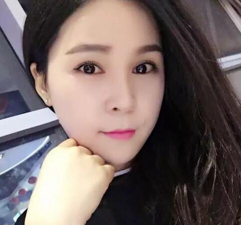 祛斑方法分享:43岁妇女变少女,肌肤白皙水嫩,老公儿子不敢认 祛斑方法分享:43岁妇女变少女,肌肤白皙水嫩,老公儿子不敢认
