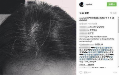 赛立复NMN让白头发变没,年轻了30岁!邓超舒淇也羡慕 赛立复NMN让白头发变没,年轻了30岁!邓超舒淇也羡慕